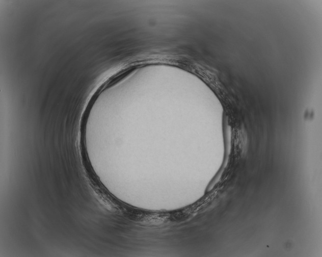 X0000097620148200803281044