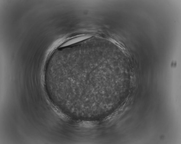 X0000097620149200803281044