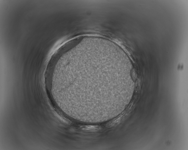 X0000097620151200803281044