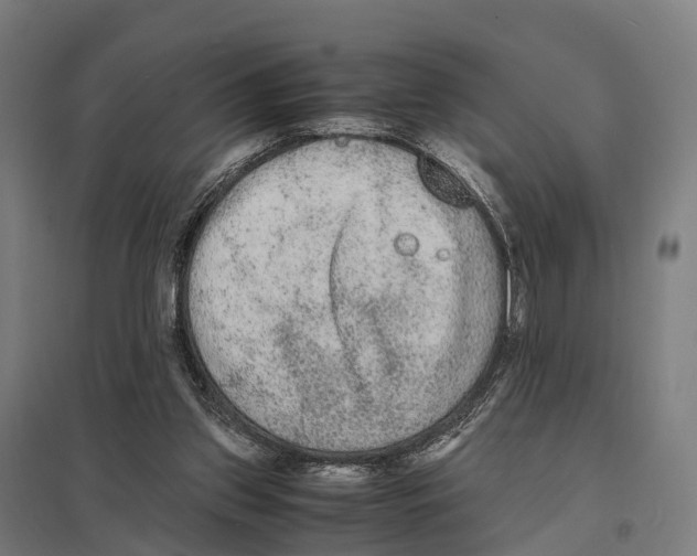 X0000097620157200803281044