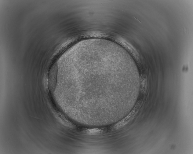 X0000097620158200803281044