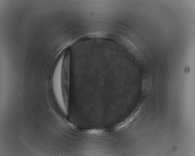 X0000097620168200803281044