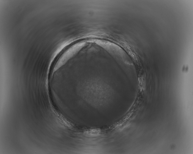 X0000097620196200803281044
