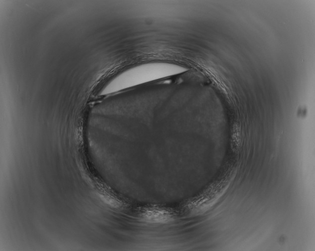 X0000097620547200803281038