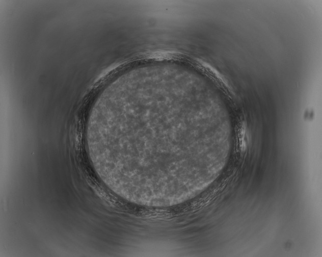 X0000097621158200803281030