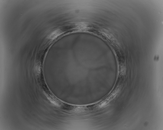 X0000097621161200803281030