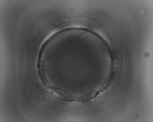 X0000097621173200803281030