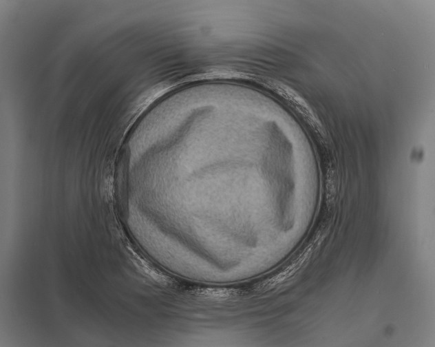 X0000097621177200803281030