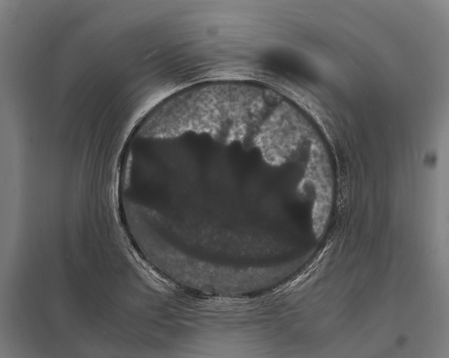 X0000097621179200803281030