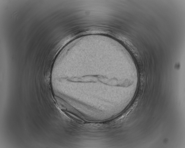 X0000097621185200803281030