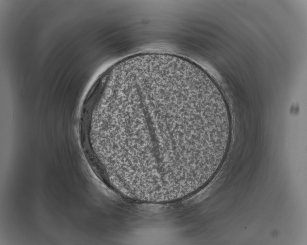 X0000097621248200803281029