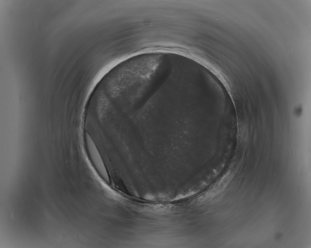 X0000097621533200803281025