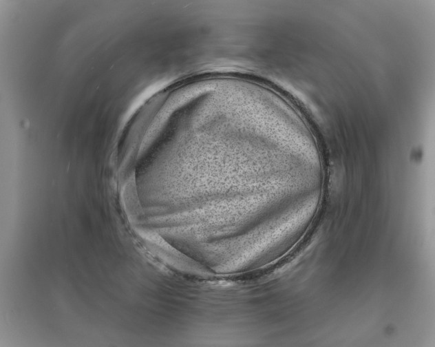 X0000097631317200803142016