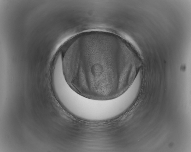 X0000097631360200803142015