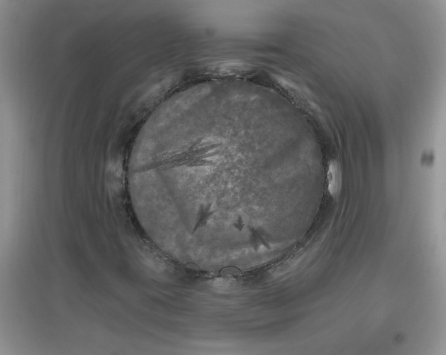 X0000097631395200803142014