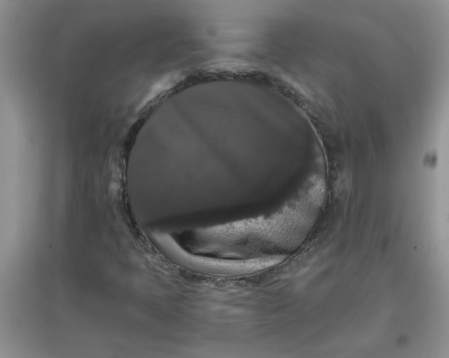 X0000097631397200803142014