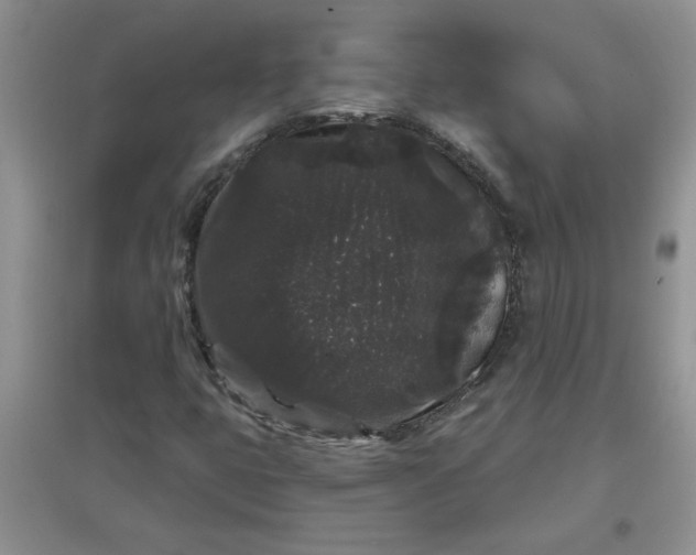 X0000097631399200803142014