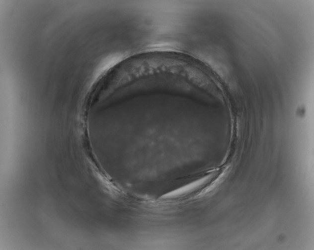 X0000097631405200803142014