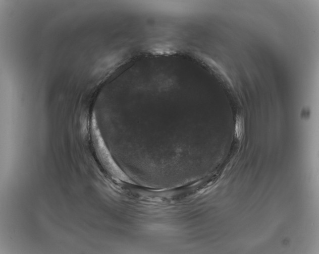 X0000097631444200803142014