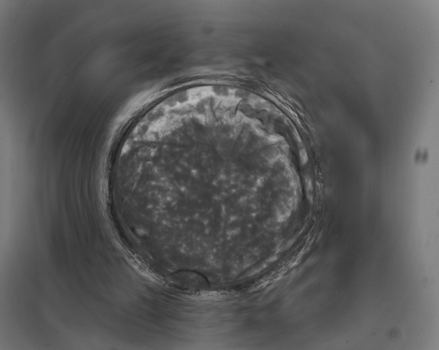 X0000097630149200803281108