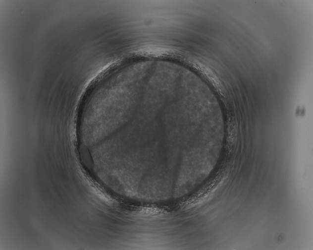 X0000097630399200803281105
