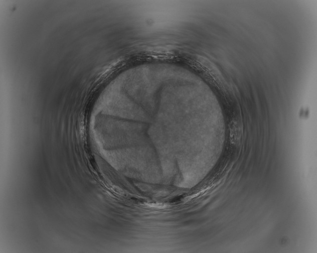 X0000097631298200803281050
