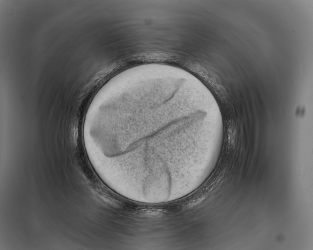 X0000097640206200803281130