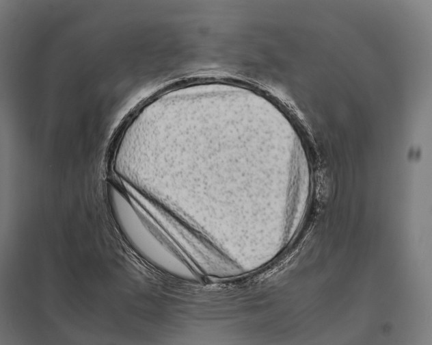 X0000097641167200803281116