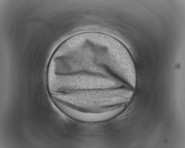 X0000097641527200803281112