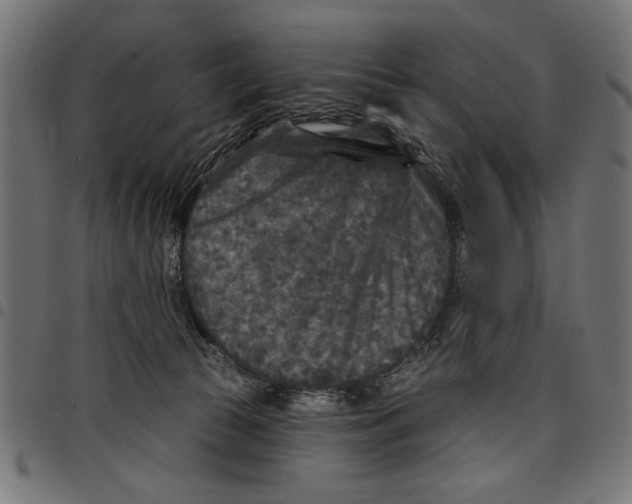 X0000097650177200803280937