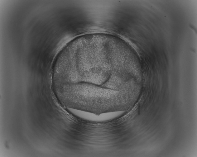 X0000097651415200803280919