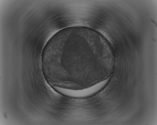 X0000097651468200803280918