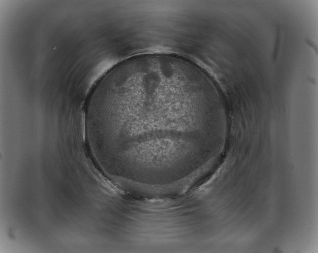 X0000097661171200803071525