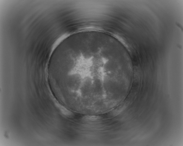 X0000097661474200803071521