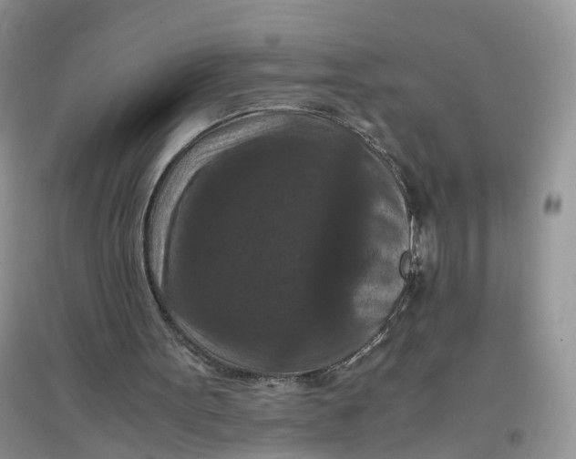 X0000097660099200803142141