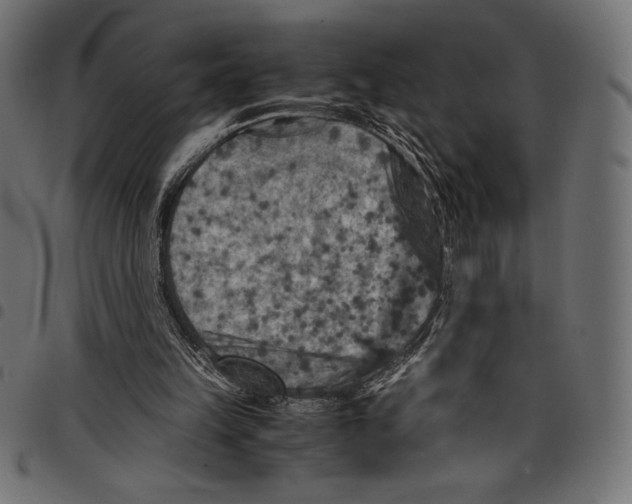 X0000097660149200803280958