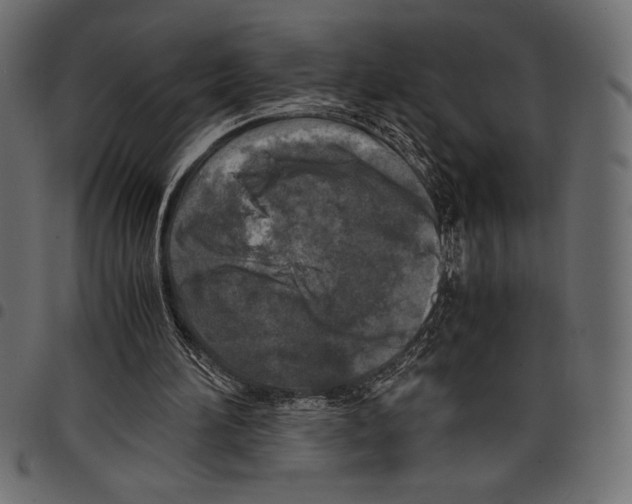 X0000097660196200803280958