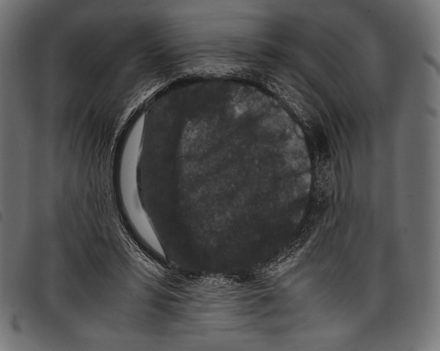 X0000097660399200803280955