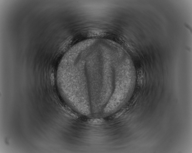 X0000097660716200803280951