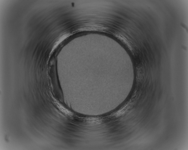 X0000097661114200803280945