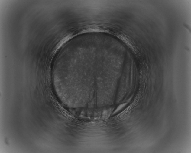 X0000097661173200803280944