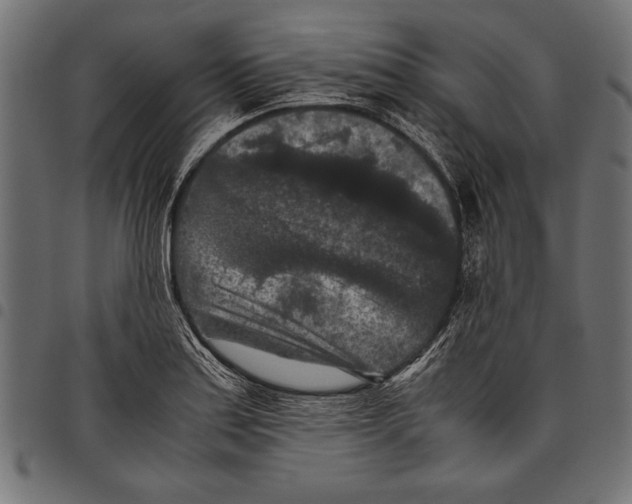 X0000097661179200803280944
