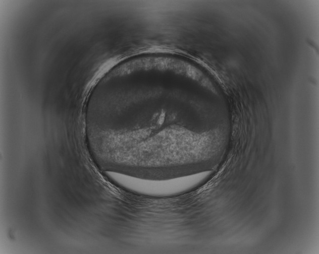 X0000097661367200803280942