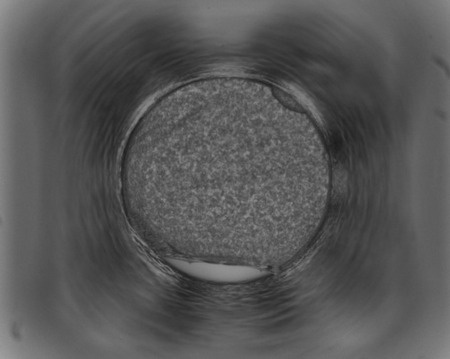 X0000097661435200803280941