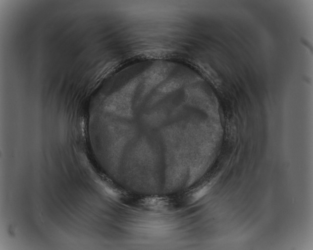 X0000097670117200803281021