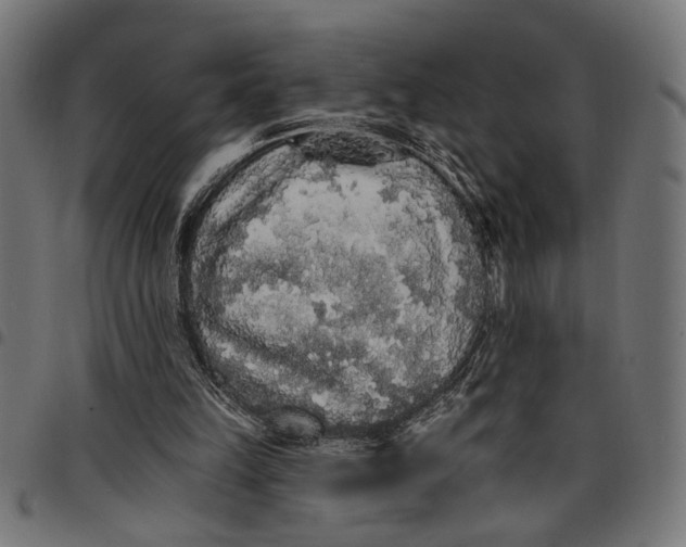 X0000097670149200803281020