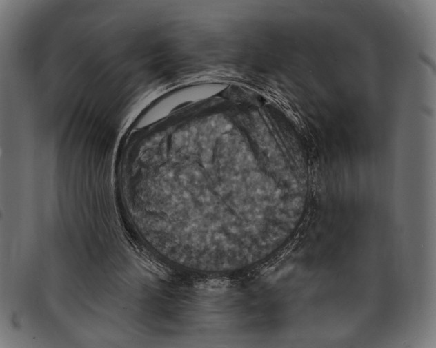 X0000097670196200803281020