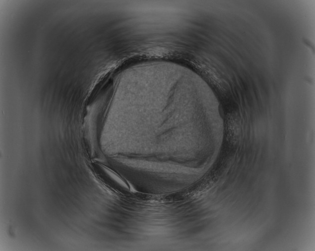 X0000097670496200803281015