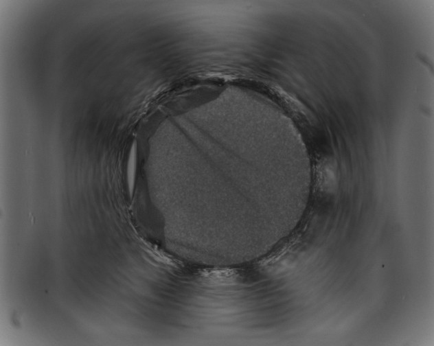 X0000097670517200803281015