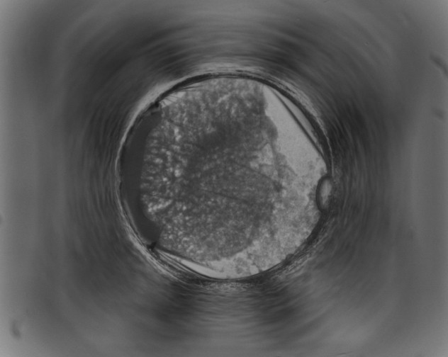 X0000097671045200803281008